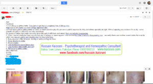 Homeopathic Treatment of Skin eruption, Allergy, Itching, Dryness, Nail Fungus – A feedback from an Online Client