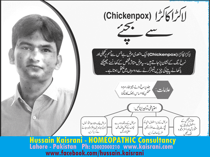 چکن پاکس، لاکڑا کاکڑا کیا ہے اور ہومیوپیتھک علاج کیا۔ حسین قیصرانی