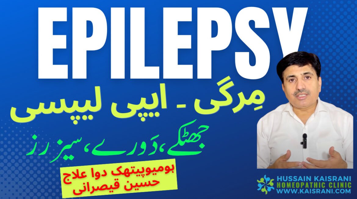 Mirgi k dore | epilepsy jhatke Fits seizures | Homeopathic medicine ilaj | Urdu Hindi | مرگی دورے Hussain Kaisrani